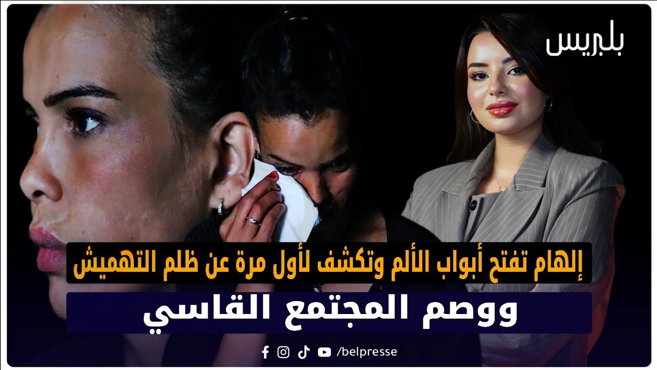 التهميش 18 “الغرفة 24”.. صرخة إلهام ضد التهميش ووصمة المجتمع